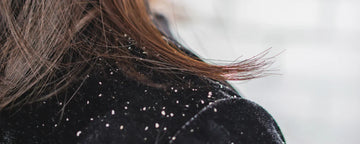 Kvinde med hvide flager på tøj