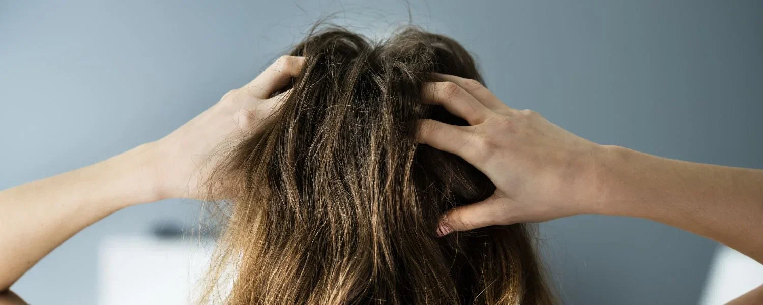 Kvinde med eksem i hovedbunden