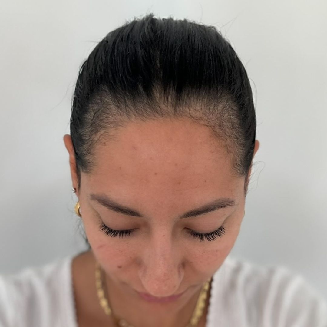 Before - Frida F.