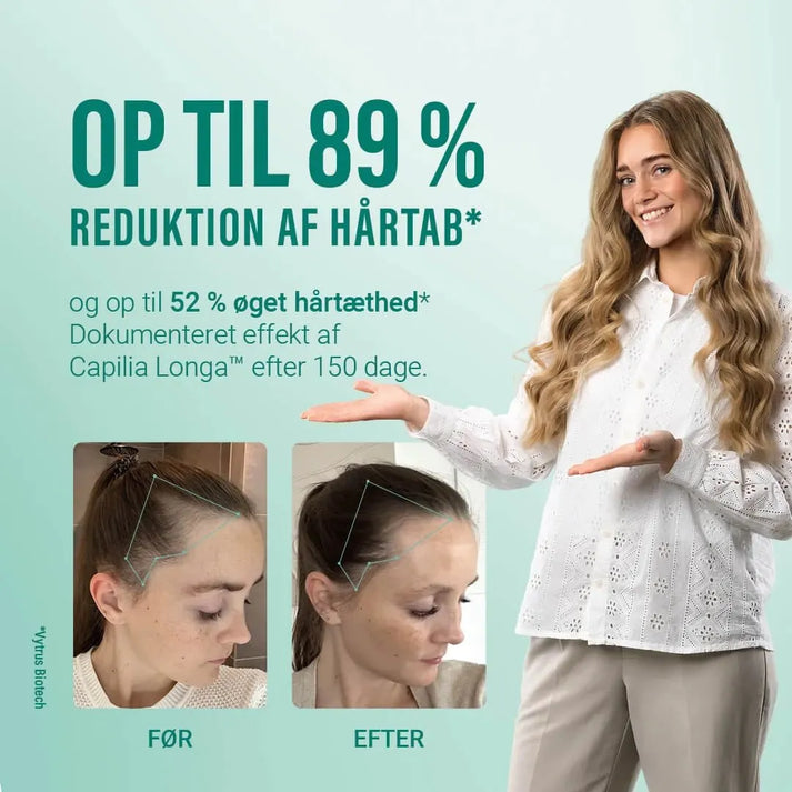 Hair Growth Starter Kit